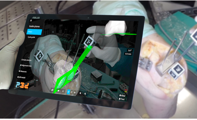 Visualization for Endoscopy R&D for CAS systems